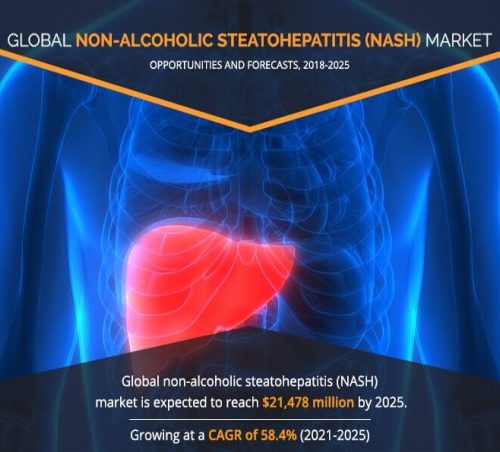 non alcoholic steatohepatitis nash market to witness a cagr of 584 during 2021 to 2025 allied market research